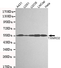 TXNRD2 Monoclonal Antibody